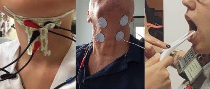 Electroestimulación como recurso auxiliar en la terapia logopédica