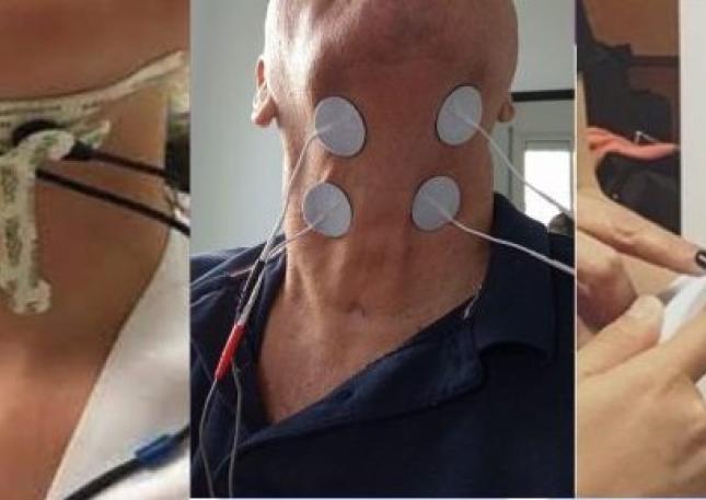 Electroestimulación como recurso auxiliar en la terapia logopédica